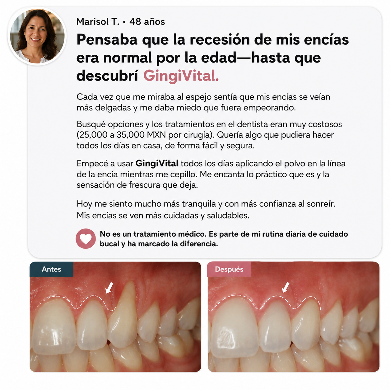 GingiVital© Polvo de Colágeno para Encías